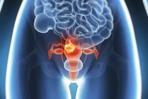 Sobre a Incontinência Urinária feminina